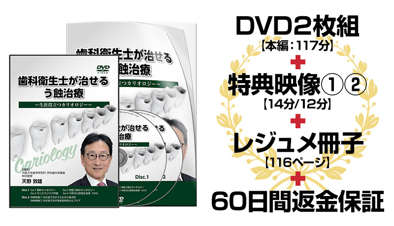 歯科衛生士が治せるう蝕治療～生涯役立つカリオロジー～