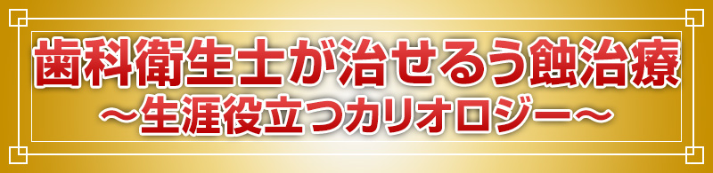 歯科衛生士が治せるう蝕治療～生涯役立つカリオロジー～