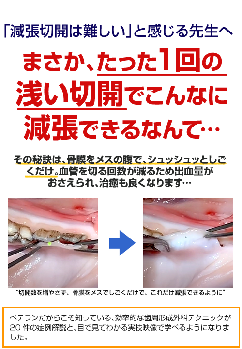 「減張切開は難しい」と感じる先生へなぜ、たった１回の浅い切開でこんなに減張できるのか？