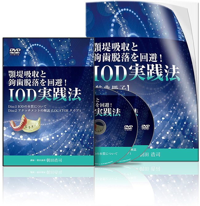 株式会社 医療情報研究所 | 顎堤吸収と鉤歯脱落を回避！IOD実践法