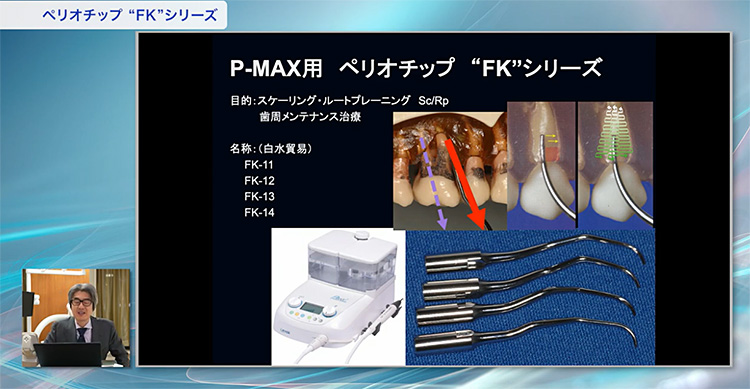 高品質なSRPが短時間でできる「秘密兵器」です