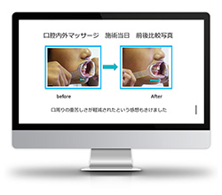 【特典動画③】口腔周囲筋ケアについて）