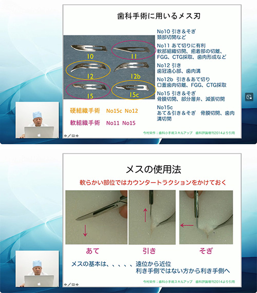 メスは、この３種類が基本のテクニックとなります