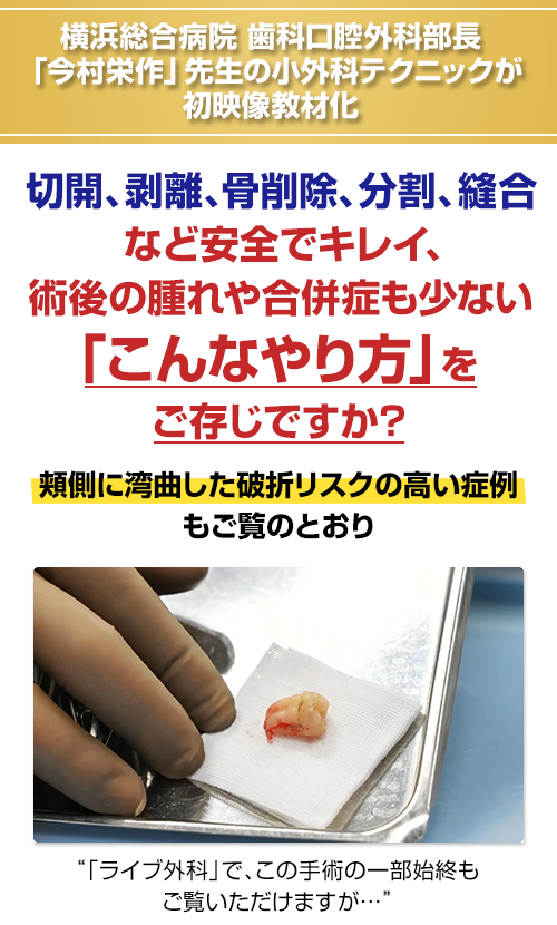 横浜総合病院 歯科口腔外科部長「今村栄作」先生の小外科テクニックが初映像教材化。切開、剥離、骨削除、分割、縫合など安全でキレイ、術後の腫れや合併症も少ない「こんなやり方」をご存じですか？