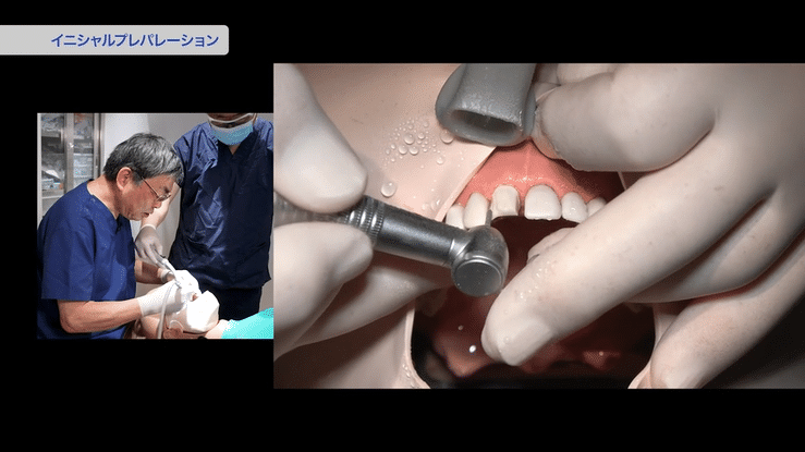 なぜ、たった半日で出血ゼロの支台歯形成が速く・上手にできるのか？
