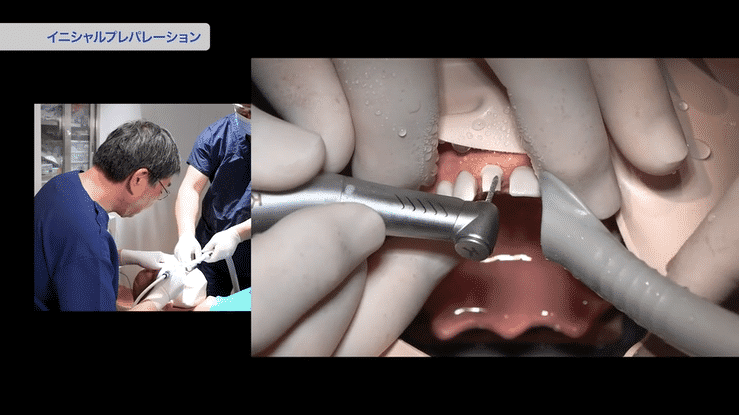 小林先生の形成テクニックを、細部まで確認できます