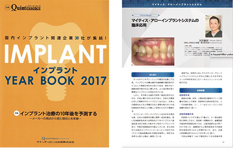 インプラントYEAR BOOK 2017