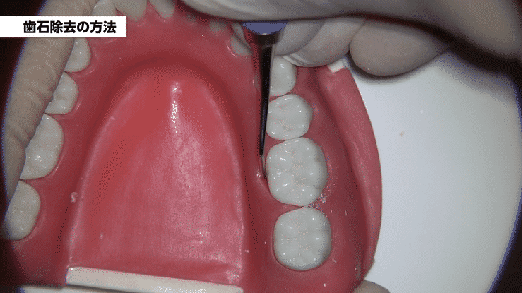 術者目線の高画質映像で細部まで確認できます