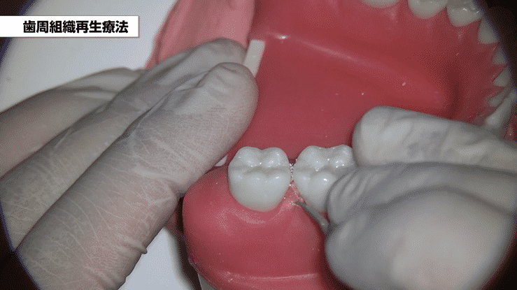 術者目線の高画質映像で細部まで確認できます