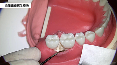 術者目線の高画質映像で細部まで確認できます