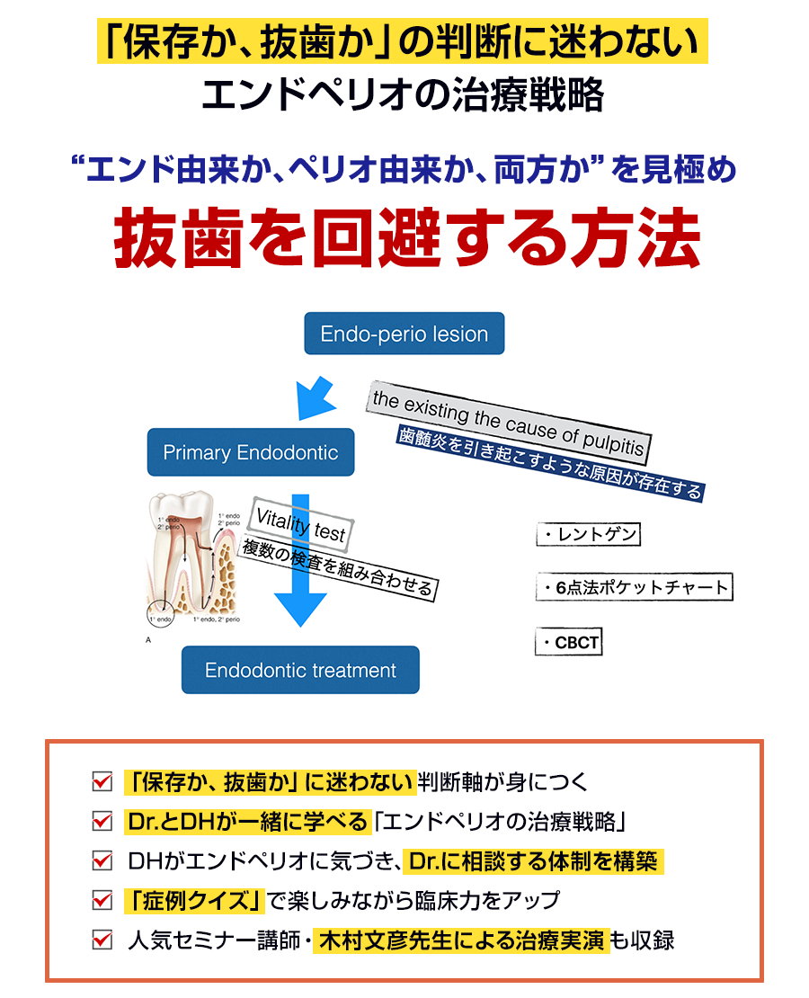 「保存か、抜歯か」の判断に迷わないエンドペリオの治療戦略“エンド由来か、ペリオ由来か、両方か”を見極め抜歯を回避する方法
