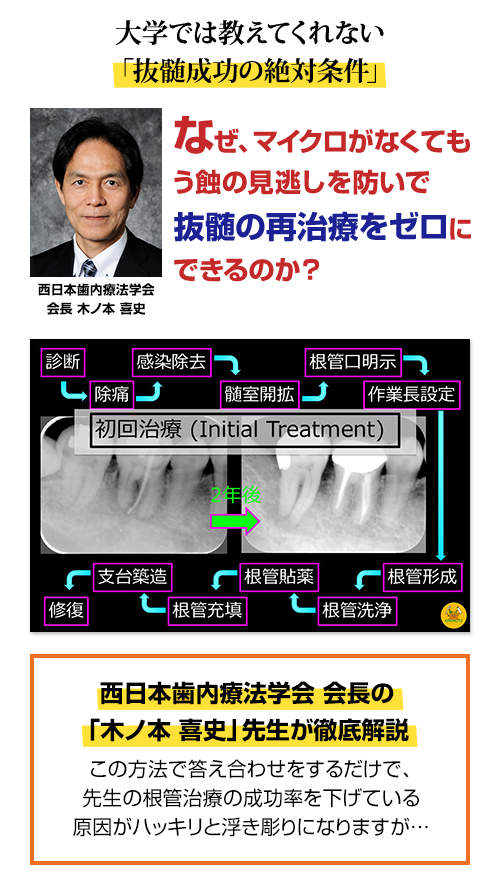 大学では教えてくれない「抜髄成功の絶対条件」なぜ、マイクロがなくてもう蝕の見逃しを防いで抜髄の再治療をゼロにできるのか？