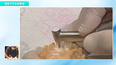 「ジルコニアならでは」の形成を、ぜひ直接ご確認ください
