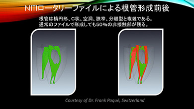 北村先生が使用している器具もご紹介します