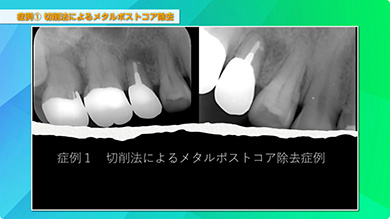 診療の幅を広げる「11症例」を解説していただきました