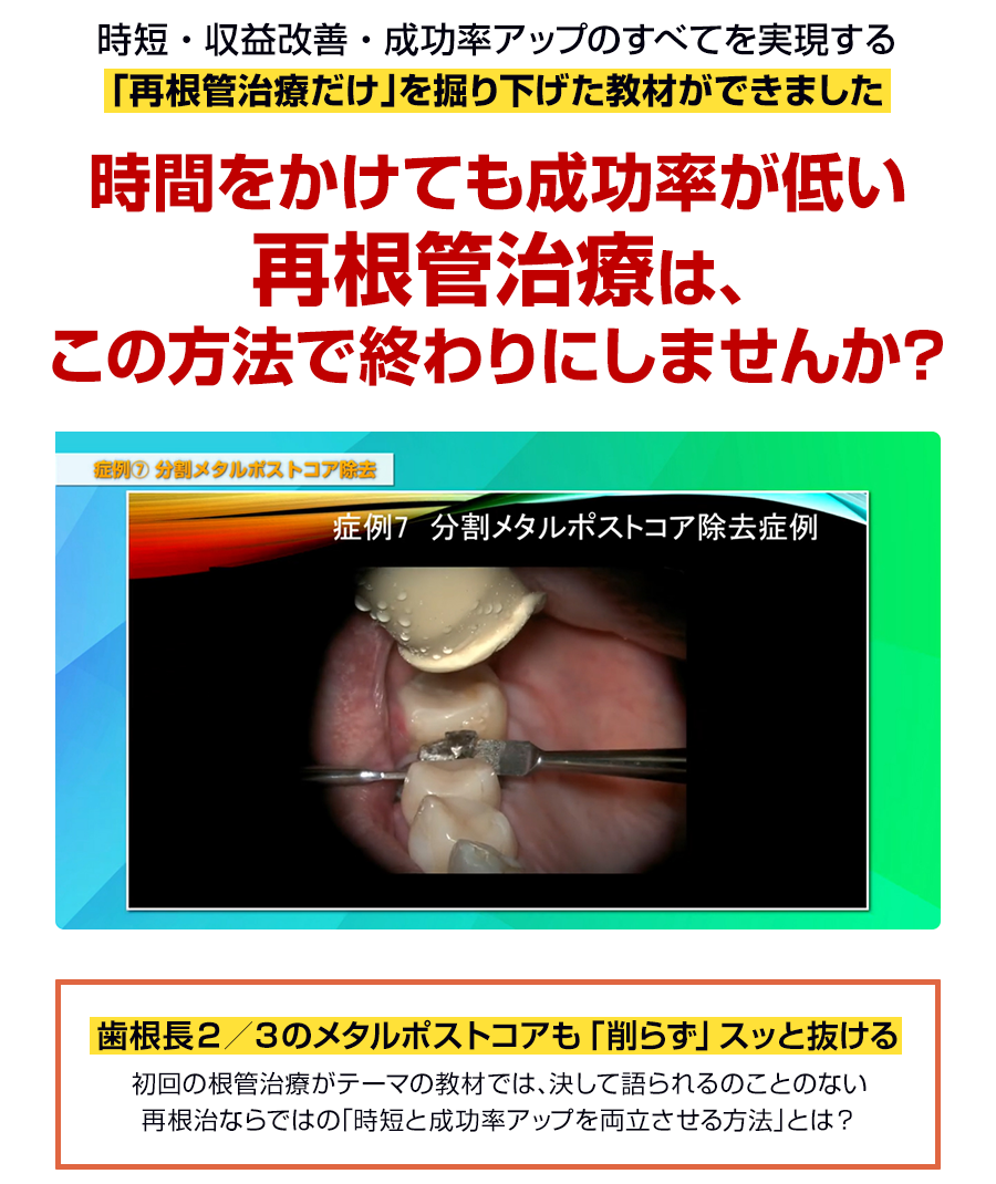 時間をかけても成功率が低い再根管治療は、この方法で終わりにしませんか？