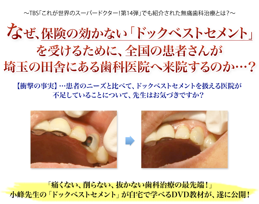 ～TBS｢これが世界のスーパードクター！第14弾｣でも紹介された無痛歯科治療とは？～なぜ、保険の効かない｢ドックベストセメント｣を受けるために、全国の患者さんが、埼玉の田舎にある歯科医院へ来院するのか…？【衝撃の事実】…患者のニーズと比べて、ドックベストセメントを扱える医院が不足していることについて、先生はお気づきですか？｢痛くない、削らない、抜かない歯科治療の最先端！｣小峰先生の｢ドックベストセメント｣が自宅で学べるDVD教材が、遂に公開！