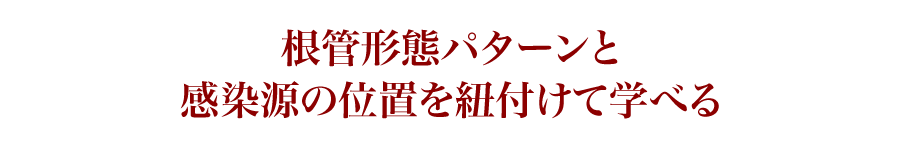 根管形態パターンと感染源の位置を紐付けて学べる