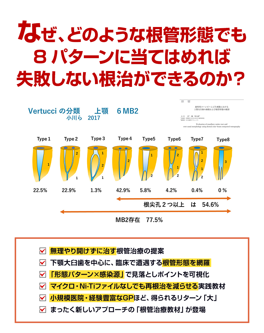 無理やり開ける治療、もう、やめませんか？全36症例の「感染源マップ」で再根治を大幅に減らせます
