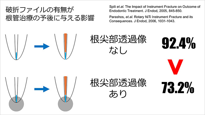 ファイル破折に対する認識が、大きく変わるはずです