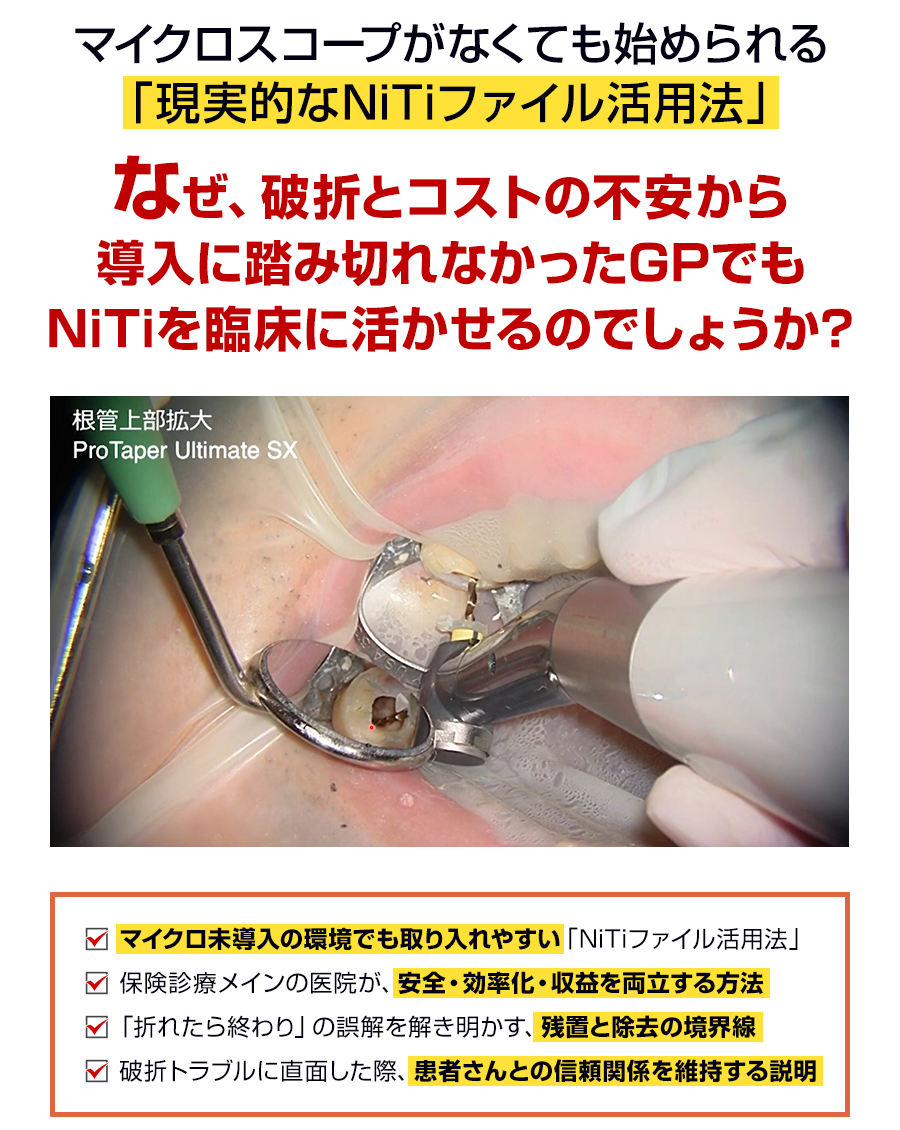マイクロスコープがなくても始められる「現実的なNiTiファイル活用法」なぜ、破折とコストの不安から導入に踏み切れなかったGPでもNiTiを臨床に活かせるのでしょうか？