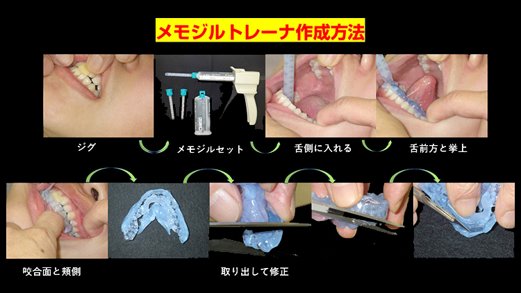 “増田先生の歯並び法を実践するのに、難しい技術は一切不要です”