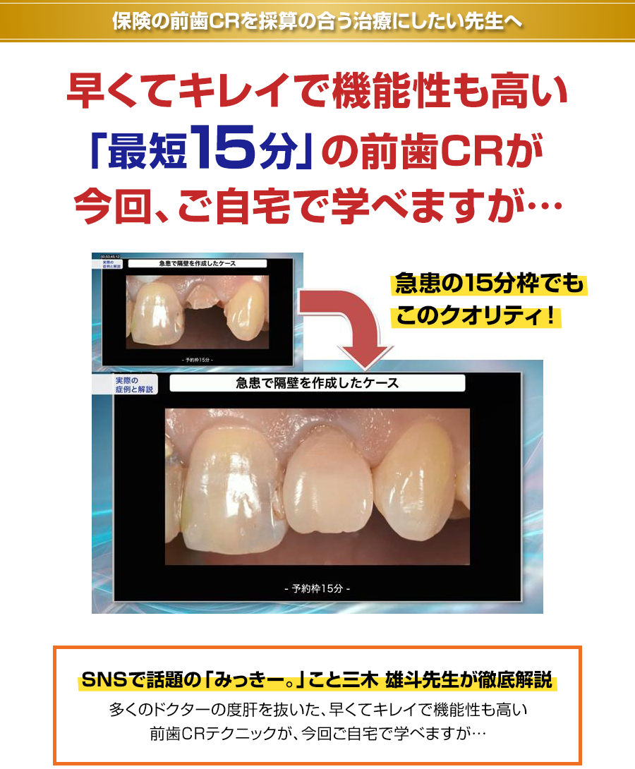 保険の前歯CRを採算の合う治療にしたい先生へ。なぜ、たった15分で患者さんも大満足の審美性の高い前歯CRができるのか？