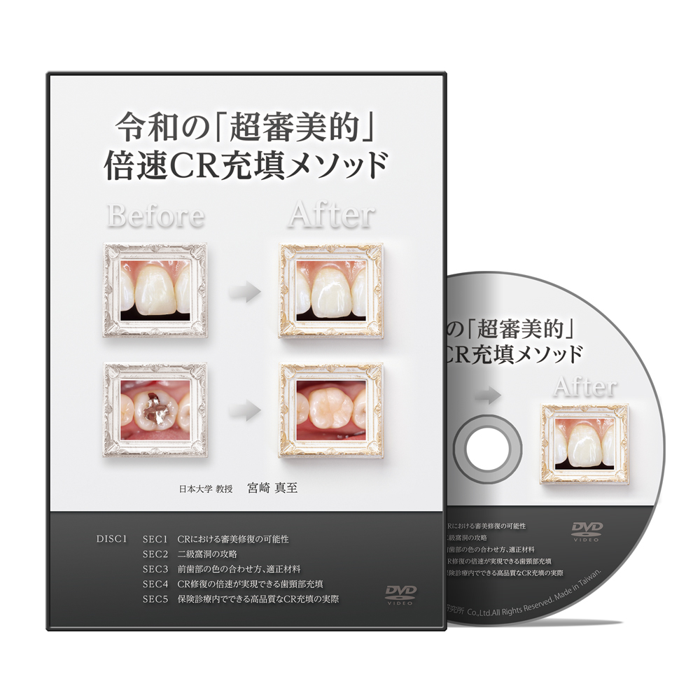 令和の「超審美的」倍速CR充填メソッド