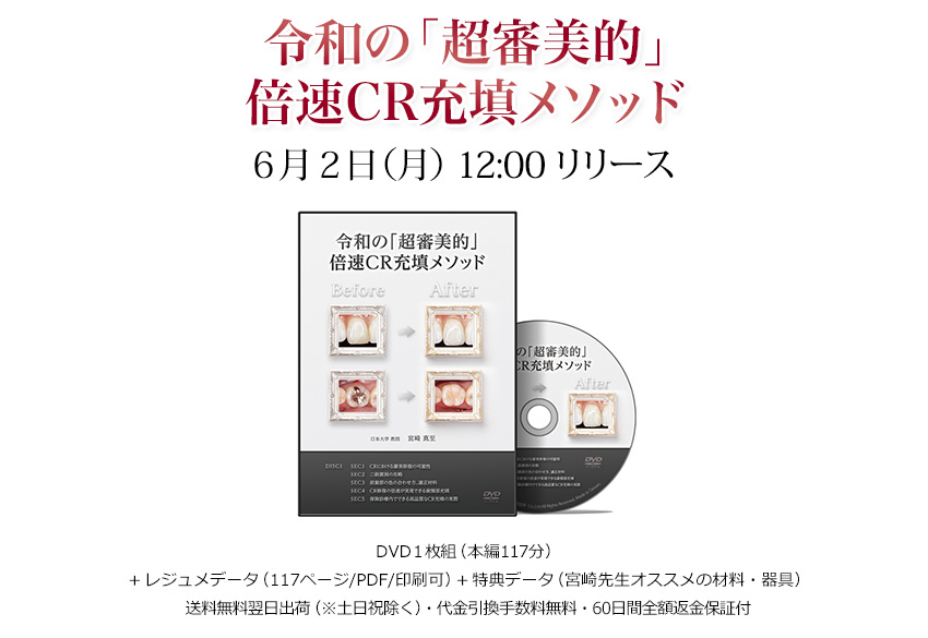 令和の「超審美的」倍速CR充填メソッド