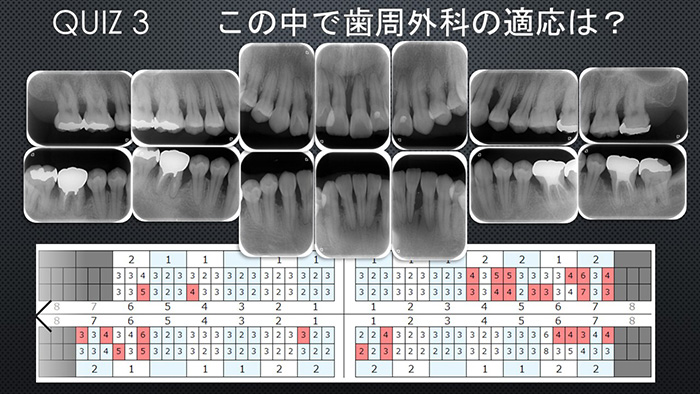院長先生とDHが一緒に学べる特別な教材です
