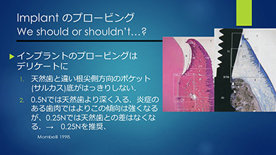 インプラント周囲炎は、これからの時代特に重要なテーマです
