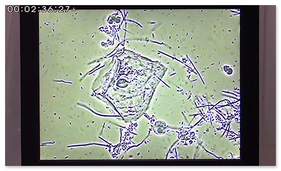患者さんへ見せる顕微鏡映像の静止画です。細かい点の部分が、すべて細菌です
