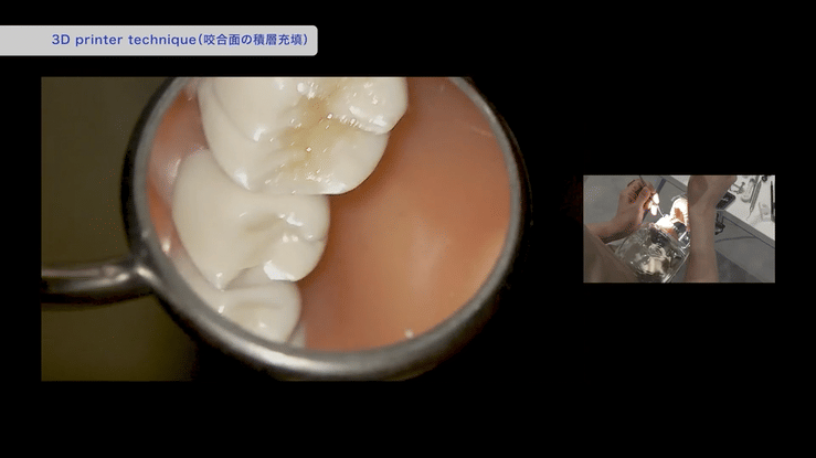 修復の一部始終を高画質映像でご確認いただけます