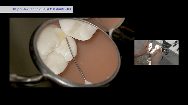 日常臨床の効率と精度を同時に引き上げるテクニックです