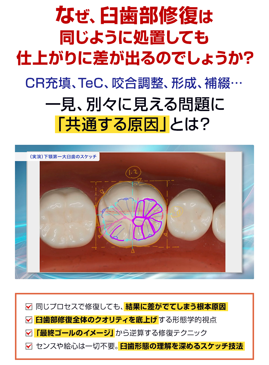 なぜ、臼歯部修復は同じように処置しても仕上がりに差が出るのでしょうか？CR充填、TeC、咬合調整、形成、補綴…一見、別々に見える問題に「共通する原因」とは？