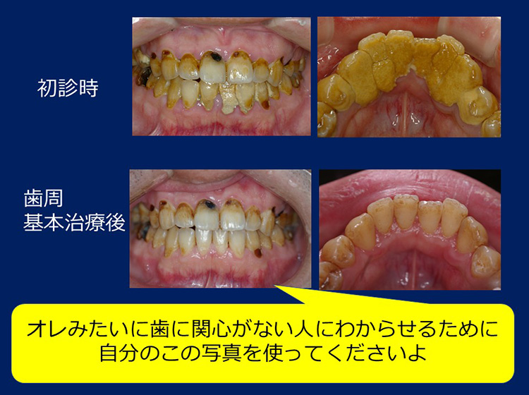 この方法なら、まるで別人のように患者さんが歯の健康に目覚めます