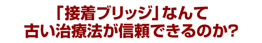 「接着ブリッジ」なんて古い治療法が信頼できるのか？