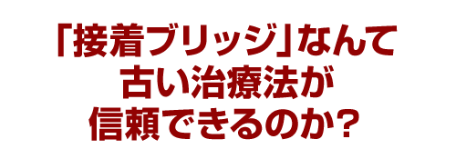 「接着ブリッジ」なんて古い治療法が信頼できるのか？