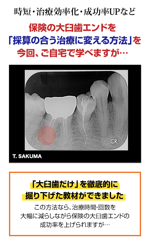 保険の根管治療を「採算の合う治療」に変えたい先生へ。なぜ、再治療をくり返してばかりの大臼歯の根管治療がたった２回で完了するのか？