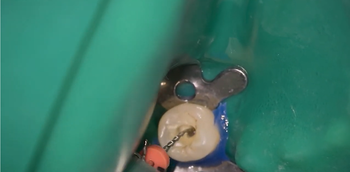 保険メインの医院でも、無理なく投資回収が可能です