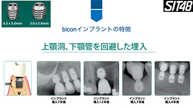 特に重要なコアテクニックは「神７」として掘り下げて解説します