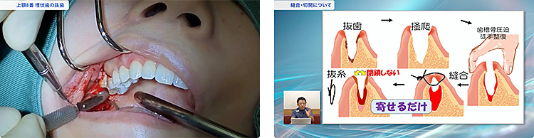 患者満足度の高い手術をしたい先生は必見の内容です