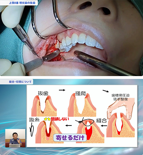 患者満足度の高い手術をしたい先生は必見の内容です
