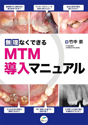 無理なくできるMTM導入マニュアル