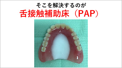 シンプルな製作ステップで、2,620点を算定可能です