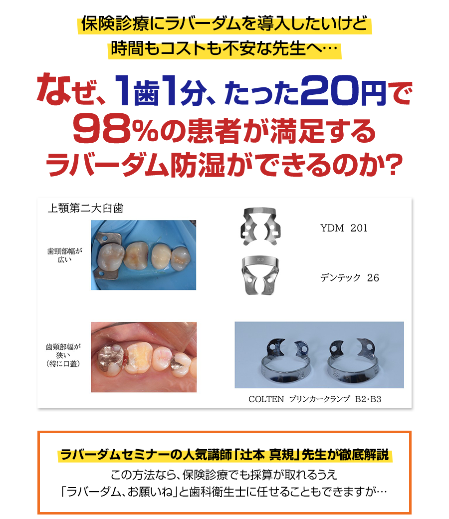 なぜ、1歯1分、たった20円で98%の患者が満足するラバーダム防湿ができるのか?