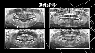まずは、「確実に30分以内に終わる症例」を選ぶ目を養ってください