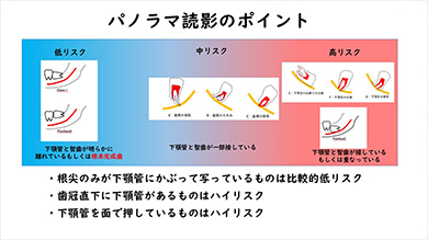まずは、「確実に30分以内に終わる症例」を選ぶ目を養ってください