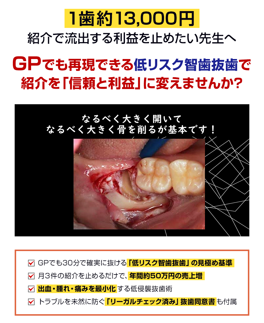 １歯約13,000円 紹介で流出する利益を止めたい先生へ…GPでも再現できる低リスク智歯抜歯で紹介を「信頼と利益」に変えませんか？