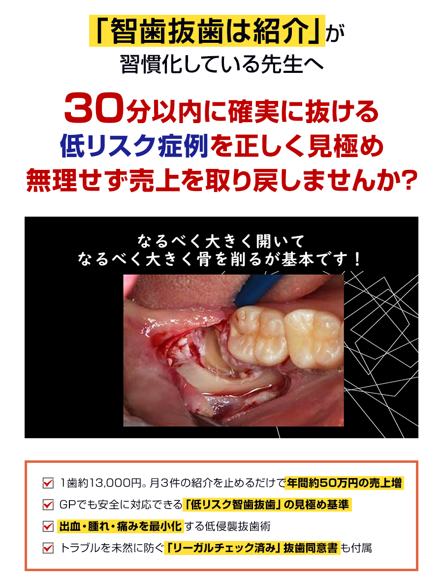 「智歯抜歯は紹介」が習慣化している先生へ。30分以内に確実に抜ける低リスク症例を正しく見極め無理せず売上を取り戻しませんか？
